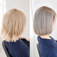 画像13407：施術事例