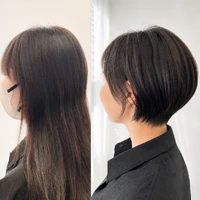 画像14757：施術事例