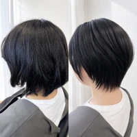 画像14765：施術事例