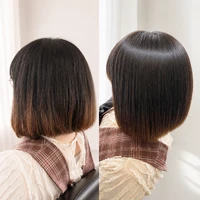 画像14777：施術事例